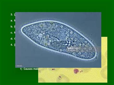  Heterotrichia: Um Ciliophora Selvagem Que Se Move Como Uma Escoba Humana!