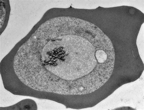  Microsporidium: Um Parasita Inesperado que Se Faz Dono das Células!