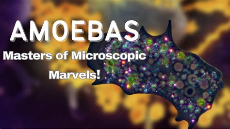  Uranium Amoeba: A Microscopic Master of Disguise and Cellular Acrobatics!